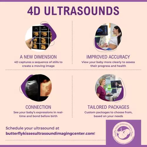 Infographic of information on 4D Ultrasounds