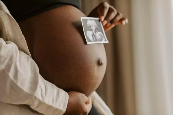 Woman holding picture of a 2D Ultrasound