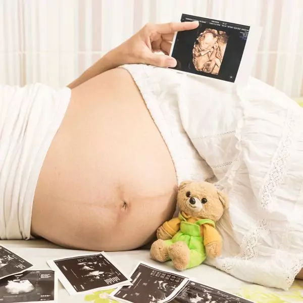 Woman holding picture of a 3D Ultrasound